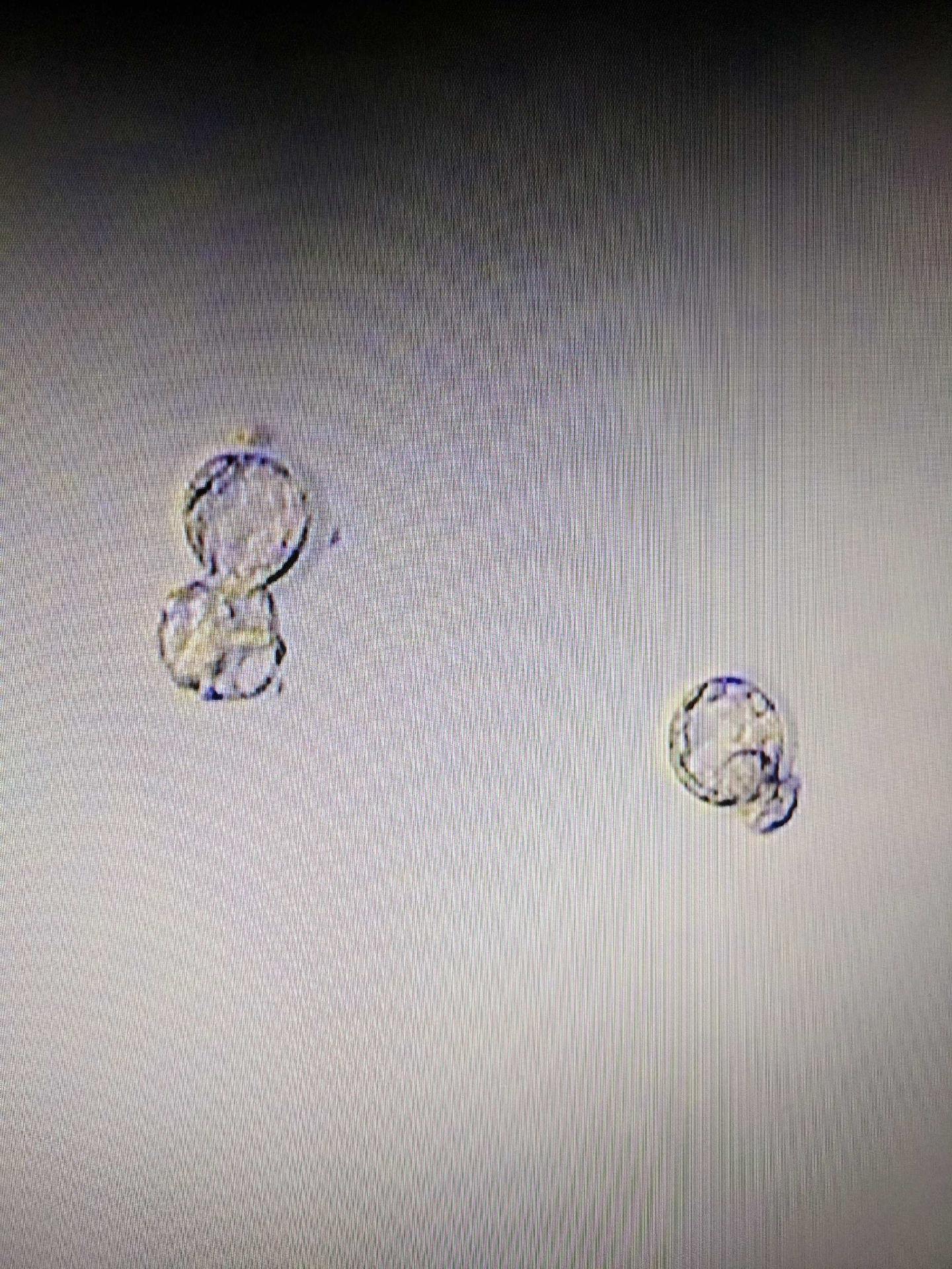 Transferred Embryos