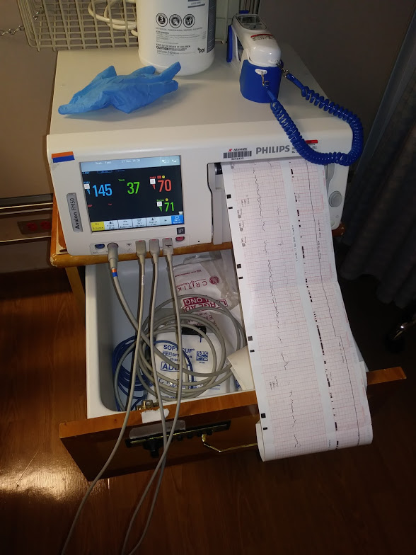 Monitor in hospital